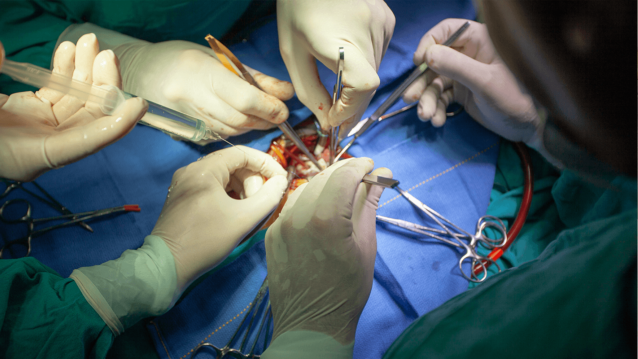 Mohki_kinderherzen_aerzte_3 OP Situation